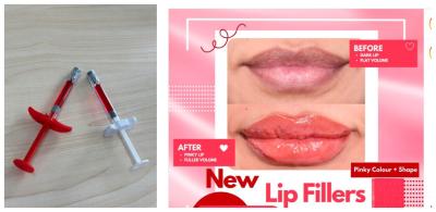 China Dermal Lip Fillers Safe Effective For Medical Professionals en venta