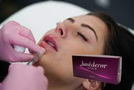 China Gezicht Lip Hyaluronzuur Dermale vulmiddel Injecties Juvederm Ultra 3 12 maanden Te koop