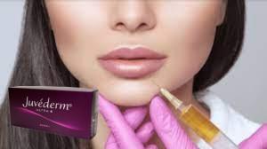 Κίνα Juvederm Ultra 4 Υαλουρονικό οξύ Συμπληρώματα χειλιών Ενέσεις Ενίσχυση χειλιών προς πώληση