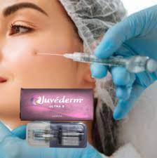 China Juvederm Ultra3 2x1ml Hyaluronzuur Gezichtsvullers Dermaal Te koop