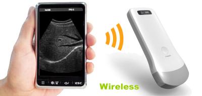 China Convex Array wireless scanner wireless ultrasound machine system for sale