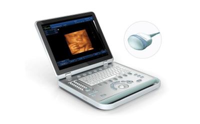 China 4D Laptop ultrasound scanner ultrasound system machine 4D image for sale