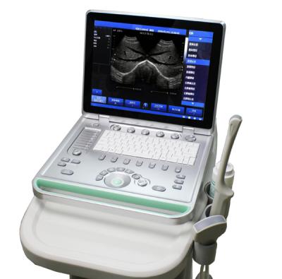 China ARM based Laptop ultrasound scanner machine system for sale