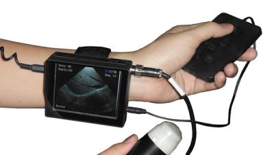 China Wrist Veterinary ultrasound scanner wrist veterinary ultrasound machine for sale