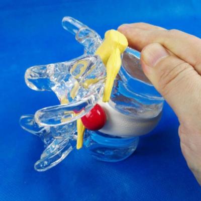 中国 Durable medical anatomy 160 four-dimensional transparent human lumbar model 販売のため