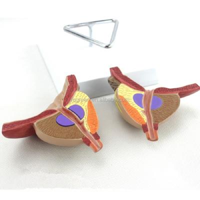 China Durable Medical Human Anatomy Model Bladder And Prostate Coronal Excision for sale