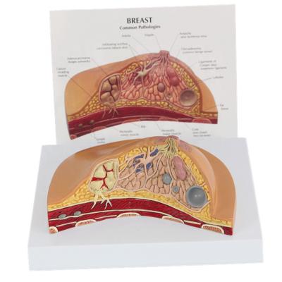 中国 Long Lasting Female Breast Anatomy Pathological Model , Female Breast Disease Teaching Model 販売のため