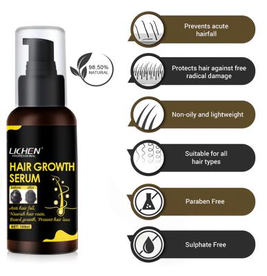 China African American Inveterate Organic Ginseng Scalp Serum African American Private Label Hair Loss Prevention Anti Hair Growth Serum for sale