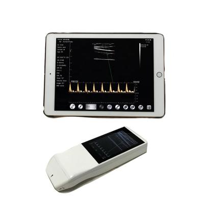 China Portable Echo Color Doppler Ultrasound Wireless Probe Diagnostic Linear Scanner With Touch Screen W3 for sale