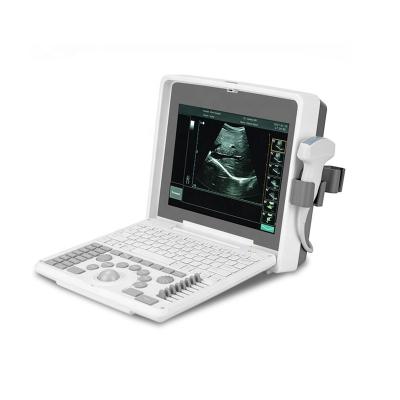 China High Frequency Portable Ultrasound Machine Conversion Notebook B/W Ultrasound Scanner BIO 3000J 3000J for sale