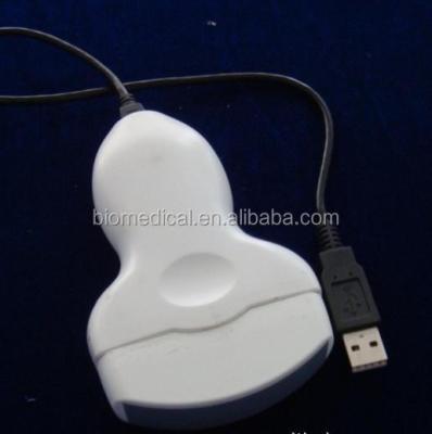 China Tablet Ultrasound Scanner with USB Probe Plug Image Storage in PC 3000C for sale