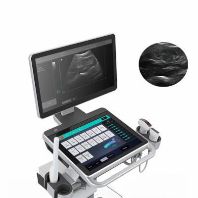 China 15 Inch Full Touch Screen Digital Trolley Ultrasound Scanner High Quality Price Ultrasonic Diagnostic System With Touch Screen for sale