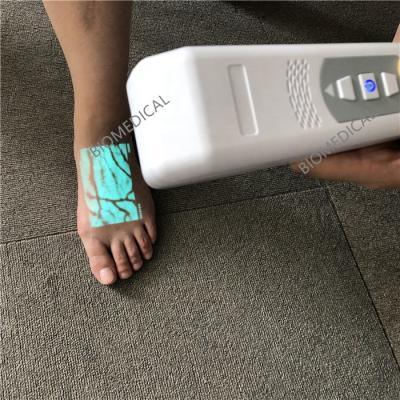 China Medical Projection Vein Finder Vein Viewer with Near Infrared Light â ‰ ¥ 1mm for sale