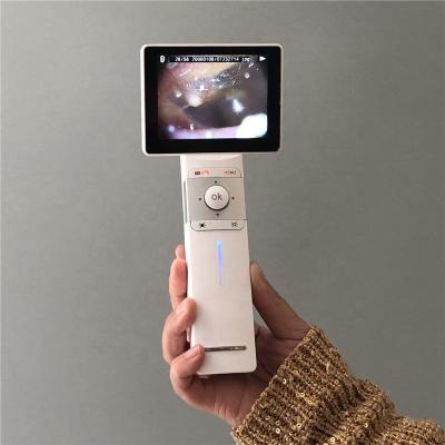 China Digital ENT Otoscope Throat Camera Dermatoscope Video Endoscope With Big Price BS4 for sale