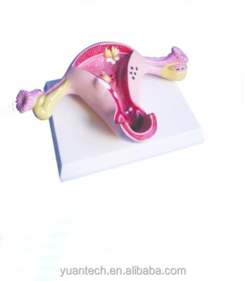 China Durable Human Anatomical Uterus Medical Model for sale