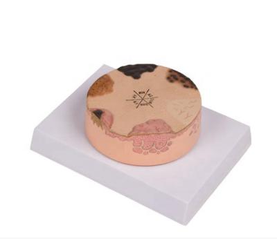 China Cutaneum Durable Human Carcinoma Anatomical Model, Skin Cancer Model for sale