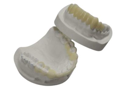 Κίνα Υψηλής αντοχής CAD CAM 3D Printing Temporary Crowns Durable Resin προς πώληση