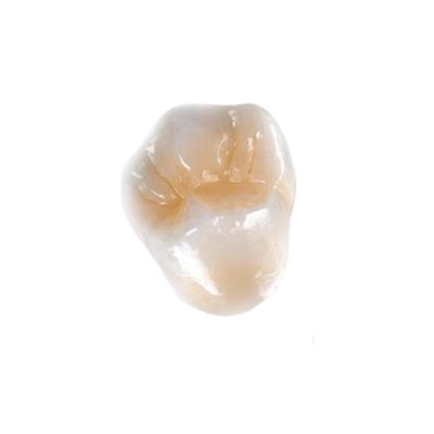 Cina Ultra duro impiallacciare le protesi dentarie Tutto ceramiche dell'impianto di lucidatura della corona dentarie in vendita