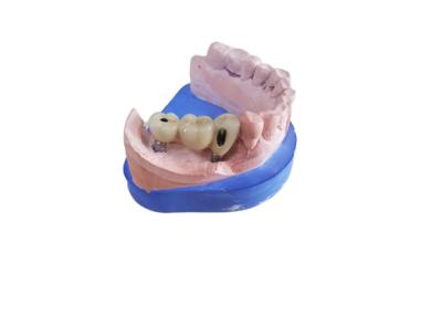 Cina Corona dentaria di biossido di zirconio di camma di cad con l'appoggio basso di titanio di biossido di zirconio in vendita