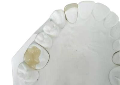 China Coroa flexível durável IPS dental E Max Press Inlay Onlay da ponte de PFM à venda