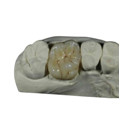 Chine Couronne dentaire de porcelaine flexible d'OIN de la CE pour la restauration de dents arrières à vendre