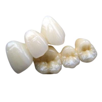 Cina Stabilità di colore su ordinazione del ponte dentario ceramico del Cr 3014652903 di PFM Co in vendita