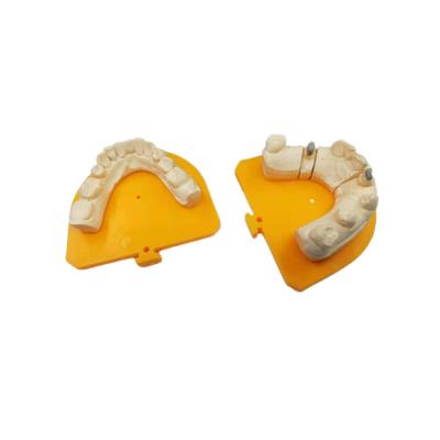 China Corona de cerámica dental de la corona PFM de la porcelana de alta resistencia del oro amarillo en venta