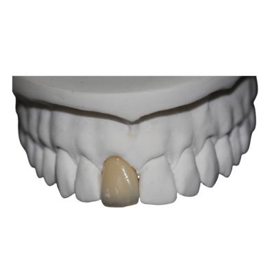 China Corona dental de la porcelana del Cr del Co en venta