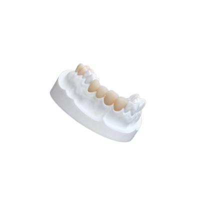 China IPS E Max Ceramic Dental Crown Comfortable Porselein Samengestelde Vernisjes Te koop