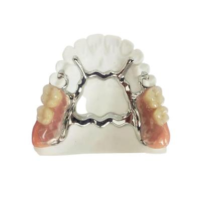 China Natrural sombrea 3D que imprime la dentadura desprendible fija para el dentista Study en venta