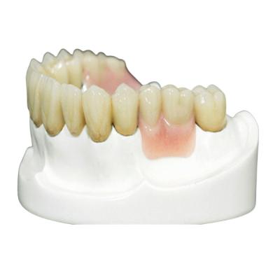 China Protección fina Overdenture de las dentaduras parciales de alta intensidad de la precisión MK1 en venta