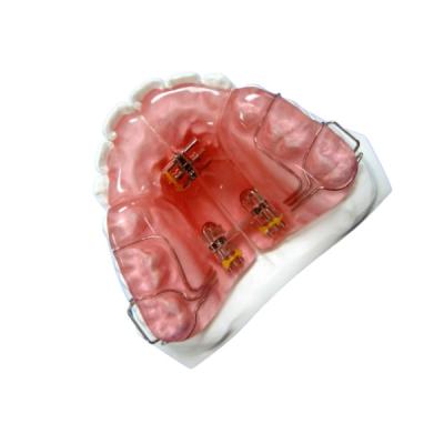 China Hoge Functionele het Toestellen Orthodontische Rubberpal van Hardheidsfda Te koop