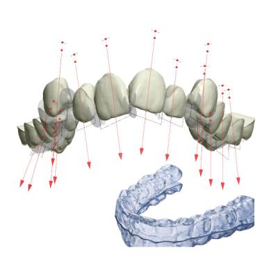 China De palsteunen FDA bevestigden Orthodontisch Toestel met 3D Te koop