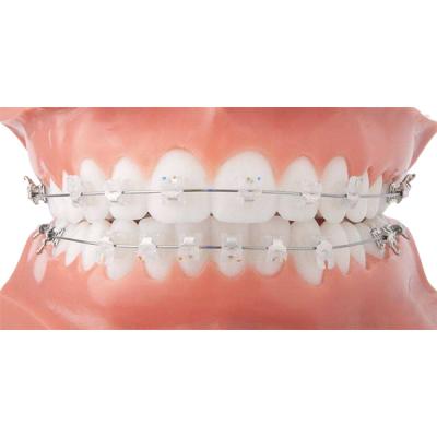 China Gemakkelijke Schone Orthodontische Ceramische Steun Mooie Vaste Orthodontische Toestellen Te koop