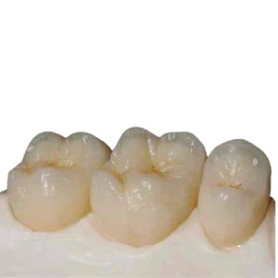 Cina Coroa dentale di zirconia personalizzata, ausiliata al computer in vendita