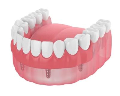 Cina Le protesi dentarie vere impianta le singole protesi dentarie Tutto ceramiche dei denti che sig.na le protesi dentarie smontabili temporanee delle protesi dentarie dei materiali da otturazione dei denti in vendita