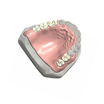 China Qualitätssicherung Lastic Enture Dental Lab Teilprothesendesign 3D-Modell zu verkaufen