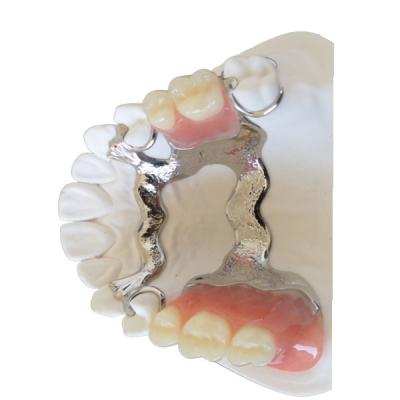 China Ponte dental bom Biocompatibility 3D de FDA PFM que imprime modelos dentais à venda