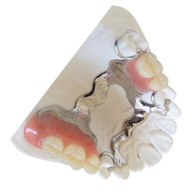 China Customized PFM Tooth Crown 3D Printing PFM Dental Bridge for sale