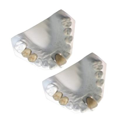 China Good Mechanical Porcelain Metal Crowns Yellow Gold High Strength for sale