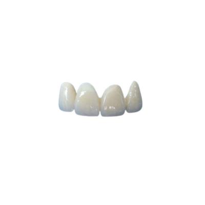 China Good Stability Ceramic Dental Crown Fit Properly Oral Hygiene High Quality for sale