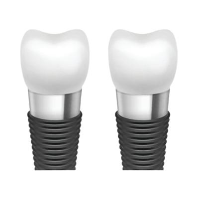 Κίνα Enhancing Oral Aesthetics With Dental Implant Bars προς πώληση