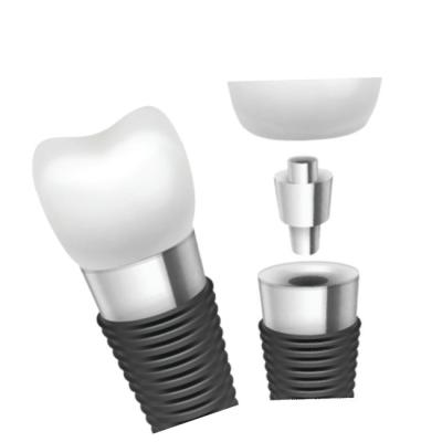 Cina Dental Implant Bars Material Innovation For Superior Performance in vendita