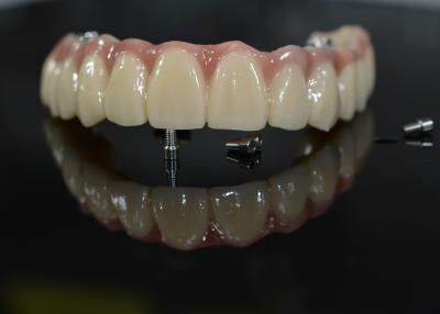 Cina Corona dentale in zirconia: denti di aspetto naturale, durevoli e sicuri in vendita