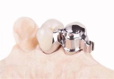 China Customized precision accessories for dental clinics en venta