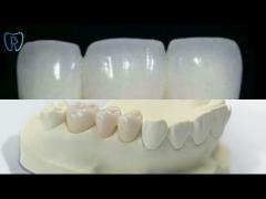 High Precision FDA CE ISO Zirconia Denture Dental Lab Custom Color