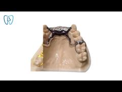 Invisible Removable Dentures Wisdom Teeth Big Teeth Restoration Implant Covering Temporary