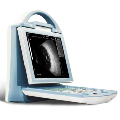 China Portable Metal Biometer US101 Full Digital Pachymeter Eye A/B Scanning Ultrasound Ophthalmic System for sale