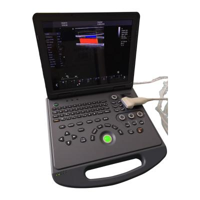 China Plastic Medical Equipment USC60 Portable Color Doppler 4D Fetal Ultrasound Machine for sale