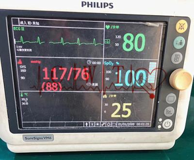 중국 재공급된 병원 환자 모니터 판매용